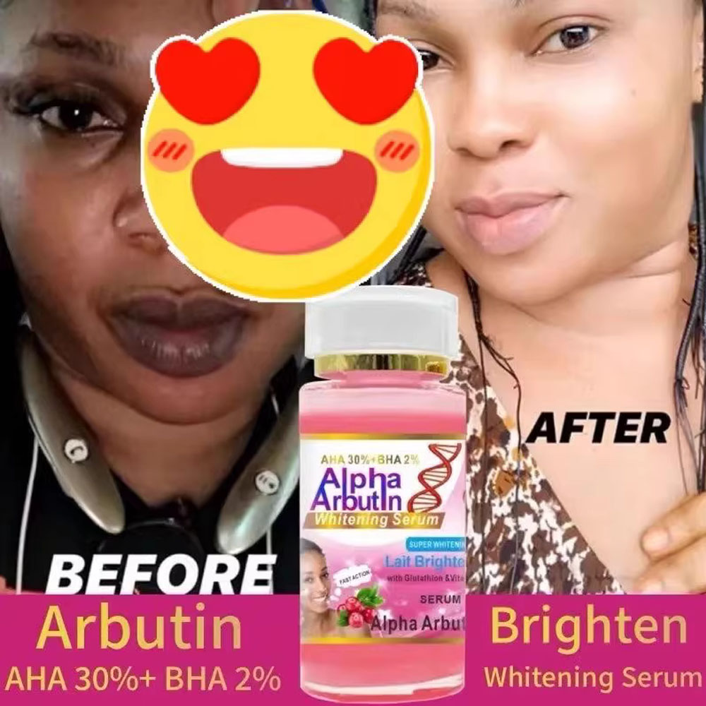 Sérum Alpha Arbutin AHA 30% +  - Alpha Arbutin Serum avis et prix