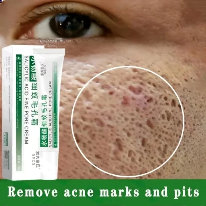 Crème de nettoyage des pores à - Azelaic Acid Cream avis et prix