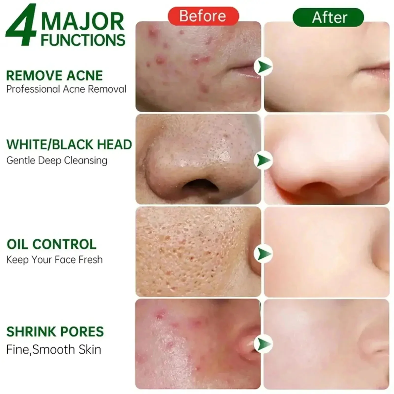 Crème de nettoyage des pores à - Azelaic Acid Cream avis et prix