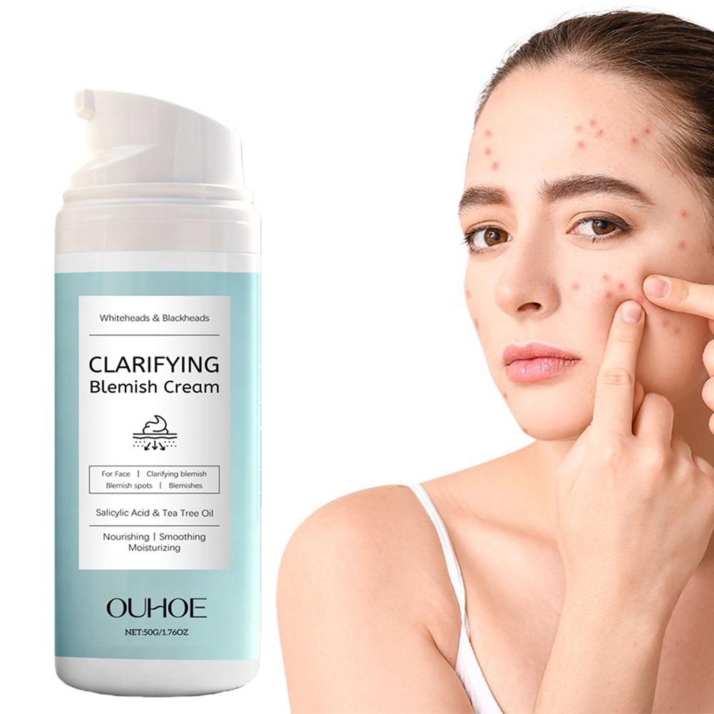 Crème pour le visage à l'acide - Azelaic Acid Cream avis et prix