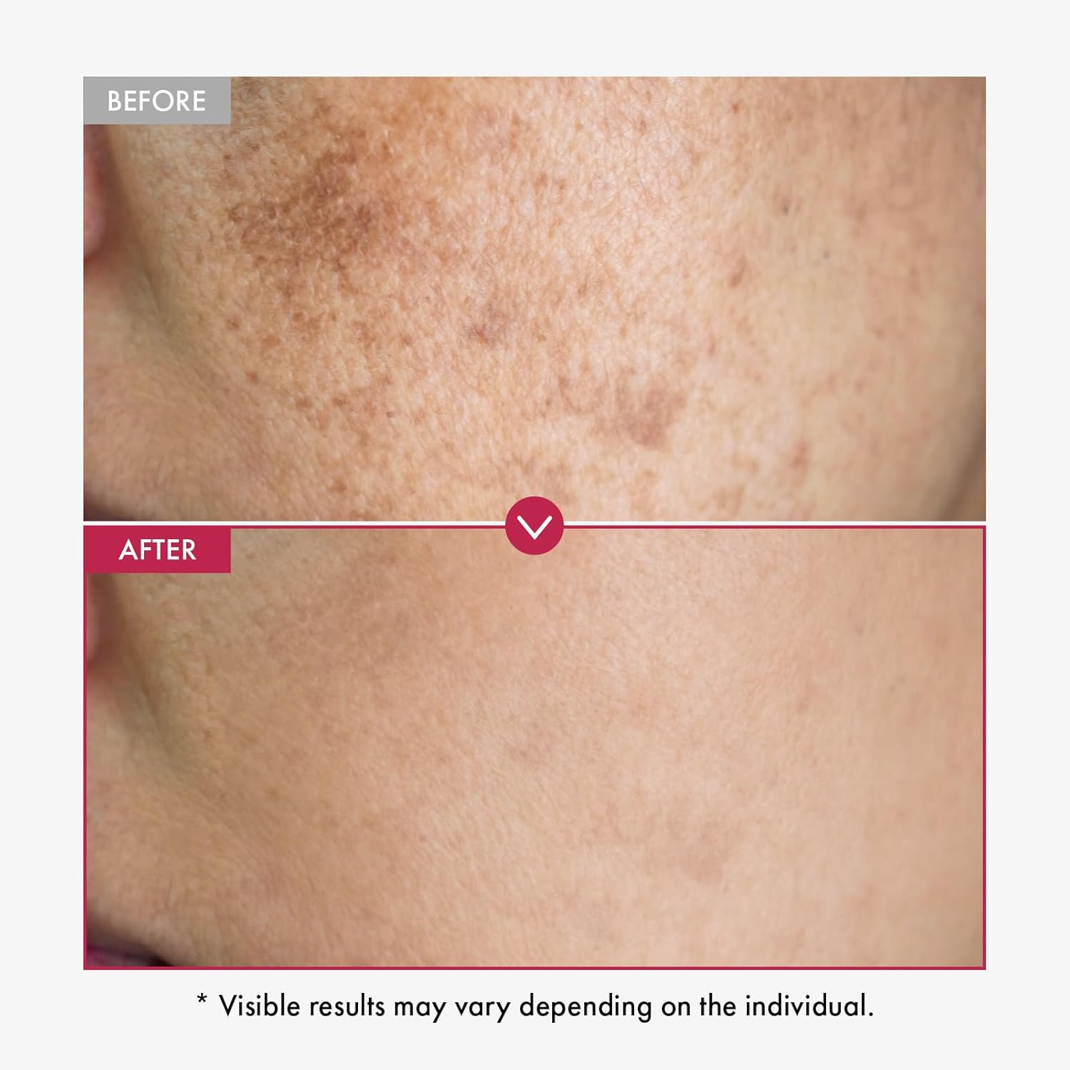 Sérum Alpha Arbutin AHA garde  - Alpha Arbutin Serum avis et prix