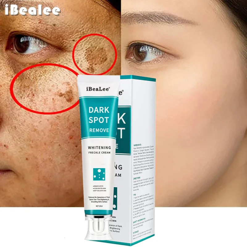 Crème blanchissante pour les t - Skincare Glowing avis et prix