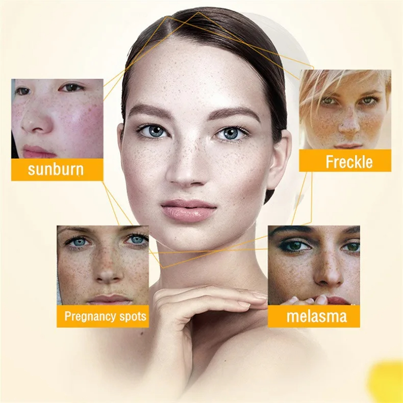 Crème blanchissante pour les t - Skincare Glowing avis et prix