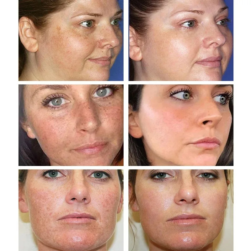 Crème blanchissante pour les t - Skincare Glowing avis et prix