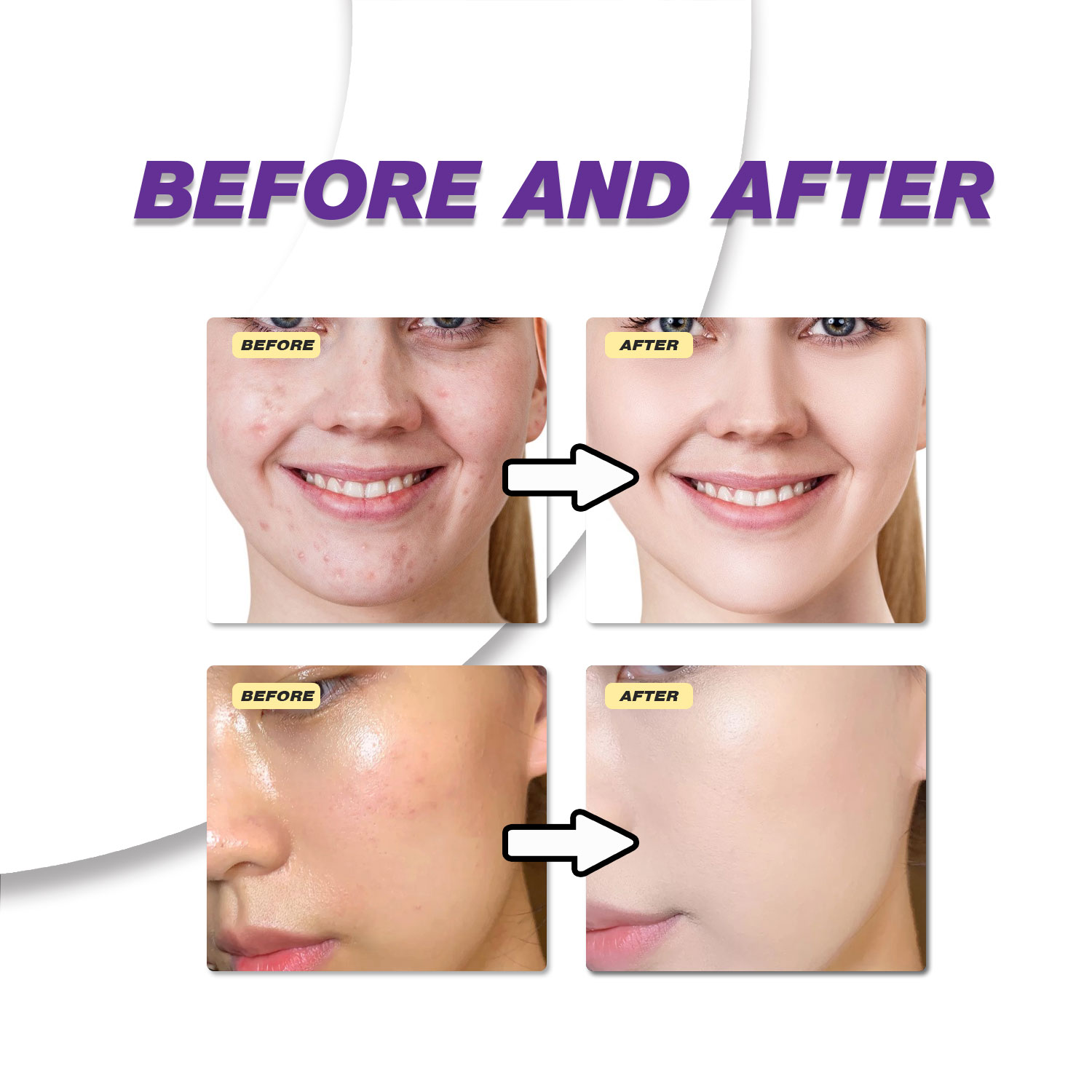 Crème à l'acide azélaïque douc - Azelaic Acid Cream avis et prix