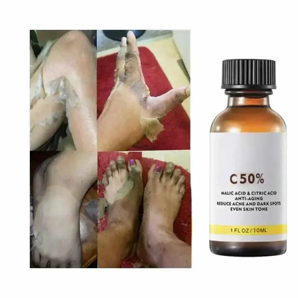 Avec acide malique et acide ci - Licorice Root Extract avis et prix